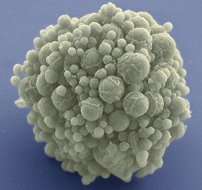 Синтетическая бактерия — Mycoplasma laboratorium JCVI-syn3.0 («Химия и жизнь» №9, 2019)