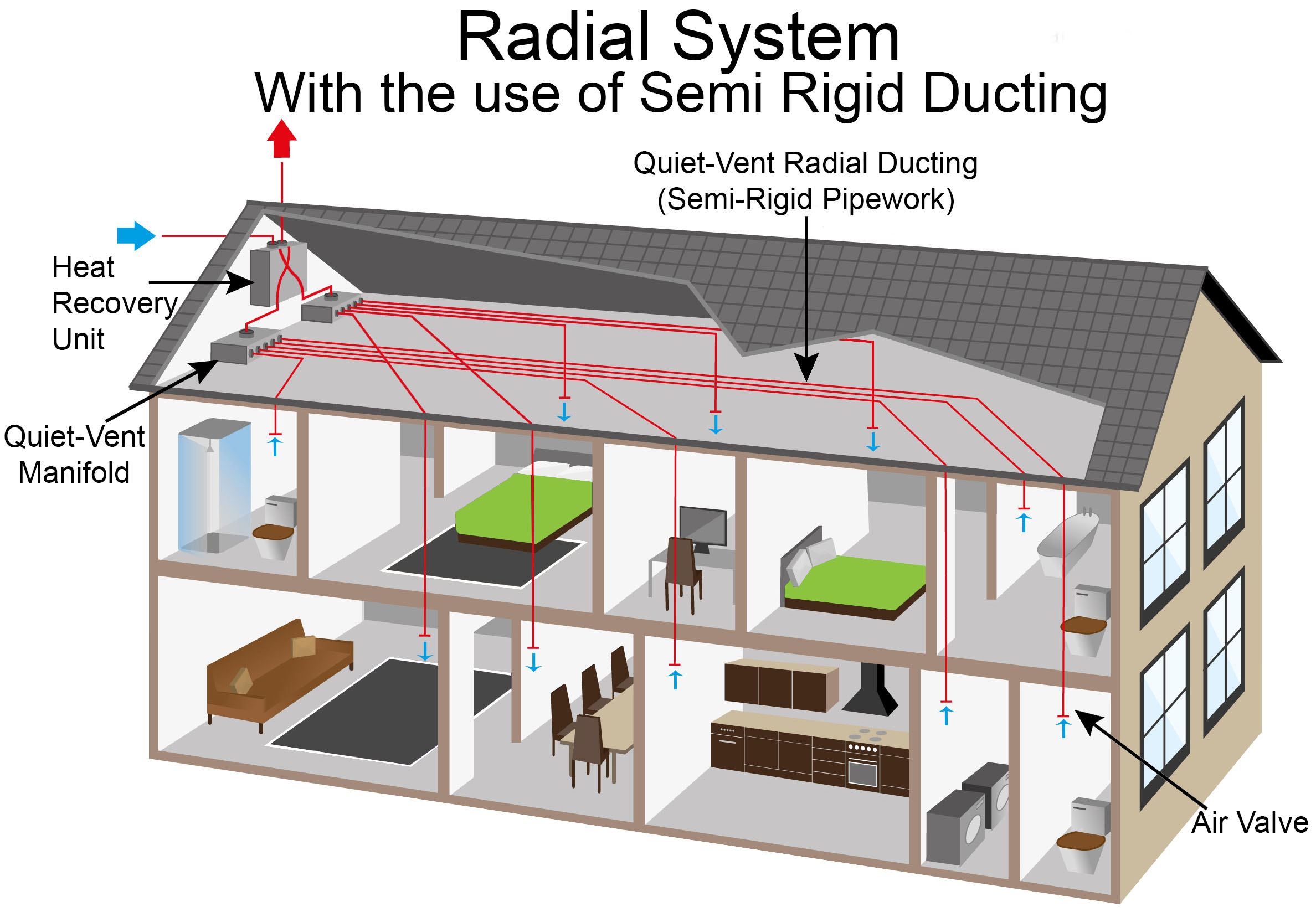 radial system